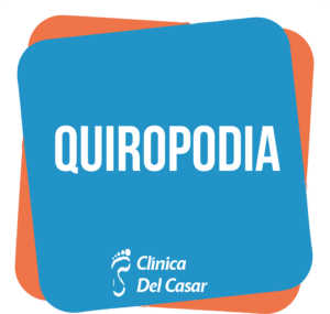 Podología, Quiropodia